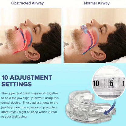 Anti-Snore Device